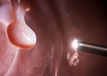 Premier Care Hospital Group Colonoscopy